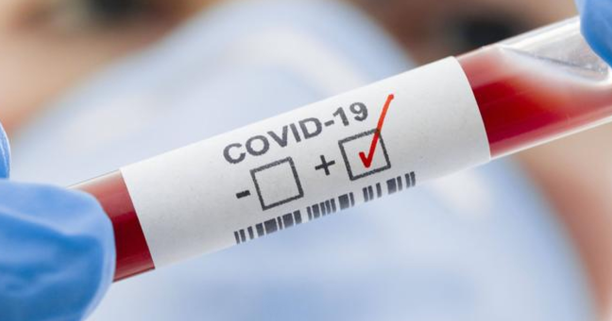 The incidence of COVID-19 in Ukraine increased by 40% compared to the previous week